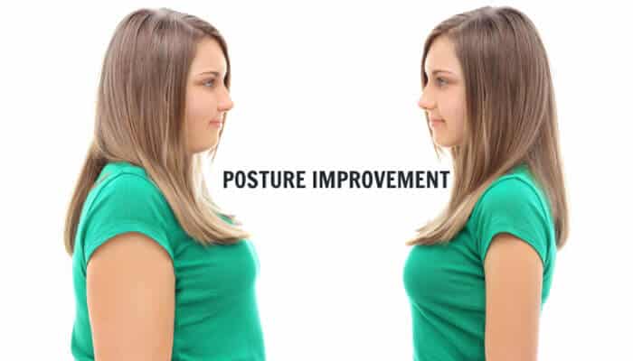 Posture Improvement - Live Casino Magic - Live CasinoMagic Fupa and posture improvement: Side-by-side comparison of a woman showing how better posture reduces the prominence of fat upper pubic area